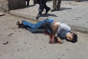kabul suicide bomber 2 300x201 - Only suicide bomber critically wounded in today’s incident in Kabul: Stanikzai
