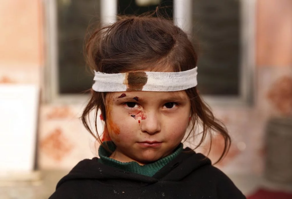5003 1024x698 - An Afghani Injured Girl