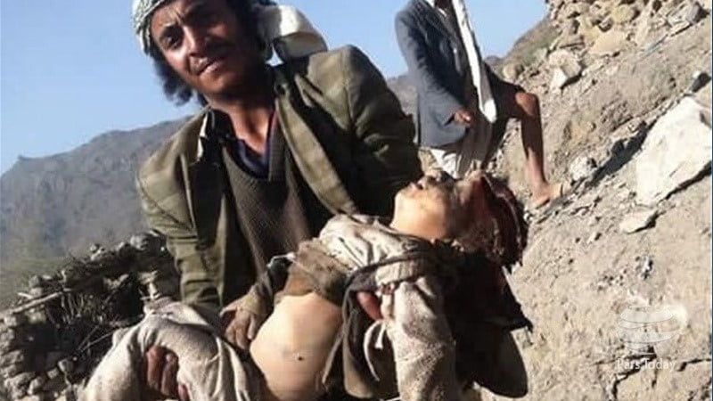 تر ۸ زرو زیات یمني ماشومان وژل شوي او ټپیان شوي دي