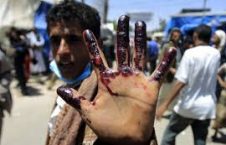 یمن 226x145 - سعودی ها درحال کوبیدن بر طبل رسوایی امریکا!