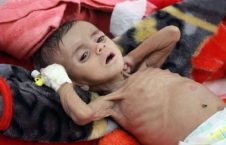 عربستان عامل انتشار وبا در یمن