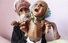 صلیب سرخ هشدار داد؛ یمن از گرسنگی در حال مرگ است!