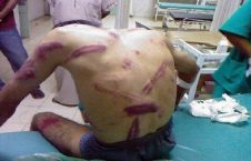 زندان بحرین 226x145 - مرگ تدریجی مظلومان در زندان سیاسی بحرین
