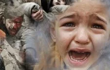 تصویری دردناک از طفل 10 ساله یمنی