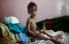 خطر وبا در کمین یمنی‌ها