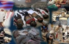 یمن 4 226x145 - جنایت نسل کشی آل سعود در یمن