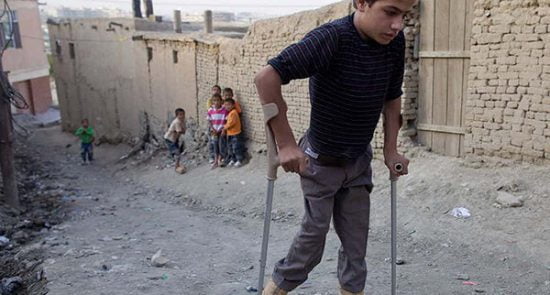 پولیو 550x295 - آمار سازمان صحی جهان درباره شمار مبتلایان به بیماری پولیو در افغانستان