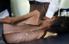 یمن 226x145 - بحران انسانی در یمن؛ ناظران سازمان ملل هشدار دادند