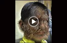 ویدیو/ پیدایش انسان گرگ نما در هند