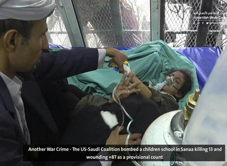 صنعا3 - قتل عام اطفال در صنعا + تصاویر (18+)
