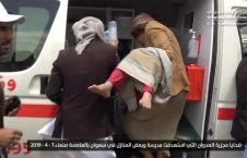 قتل عام اطفال در صنعا + تصاویر (18+)