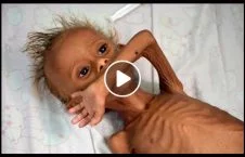 ویدیو/ اوضاع بد اطفال یمنی