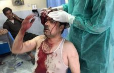 زخمی 226x145 - مذاکرات امریکا و طالبان در ساحل دریای خون مردم افغانستان