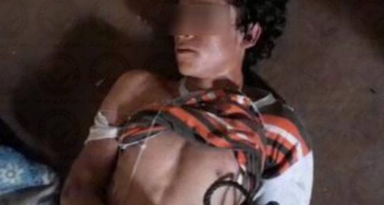 جوان افغان 550x295 - واکنش حقوق بشر به شکنجه‌ جوان 16 ساله افغان در ایران