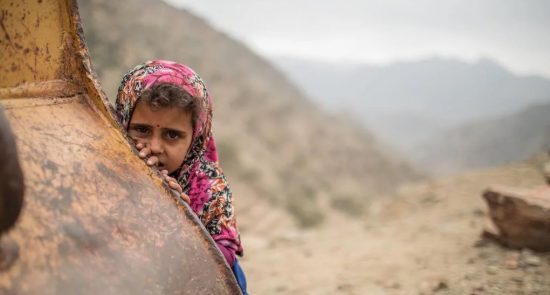 طفل یمنی 550x295 - زنده گی ملیون ها طفل در مرگبارترین مناطق جهان