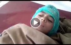 ویدیو/ زخمی شدن طفل بیگناه در انفجار امروز لغمان