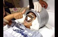 ویدیو/ نجات کودکی که سرش در دیگ گیر کرد