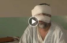 ویدیو/ مریضی ناشناخته‌‌یی که داکتران افغان قادر به تداوی آن نیستند