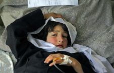 آمار وزارت صحت از بیماری بیش از یک ملیون کودک افغان