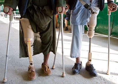 معلول. - تاکید سازمان ملل بر افزایش حمایت های مالی از معلولین در افغانستان