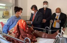 تصاویر/ عیادت سفیر افغانستان در ایران از زخمیان آتش سوزی موتر حامل مهاجرین افغان