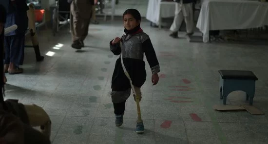 چند فیصد مردم افغانستان دچار معلولیت می باشند؟