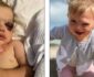طفل ۲ ساله ای که به جای اشک خون گریه می‌کند + تصاویر