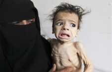 یمن 226x145 - خطر مرگ برای صدها هزار طفل یمنی به دلیل گرسنه گی