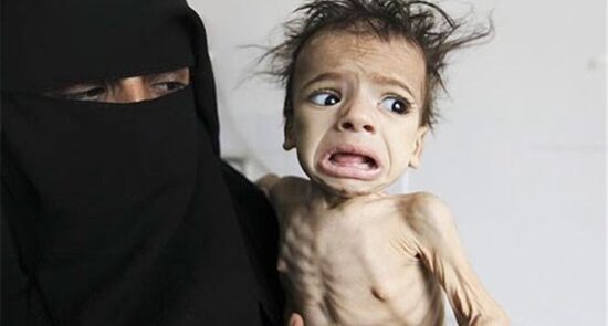 خطر مرگ برای صدها هزار طفل یمنی به دلیل گرسنه گی