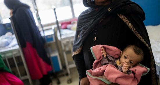 یونیسف از درمان بیش از یکصد هزار طفل مبتلا به سوء تغذیه شدید در افغانستان خبر داد