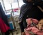 افزایش 47 فیصدی شمار اطفال مبتلا به سوء تغذیه در افغانستان