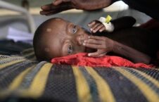 سومالیا گرسنه 226x145 - مرگ دردناک صدها طفل سومالیایی بر اثر گرسنگی