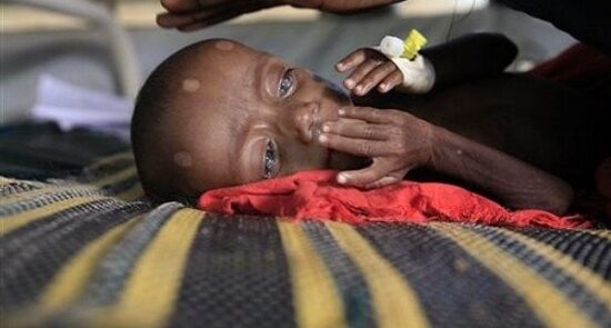 سومالیا گرسنه 550x295 - مرگ دردناک صدها طفل سومالیایی بر اثر گرسنگی