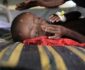 مرگ دردناک صدها طفل سومالیایی بر اثر گرسنگی