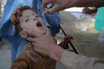 فلج اطفال 3 150x100 - تأکید رئیس جمهور غنی بر از بین بردن پولیو در افغانستان